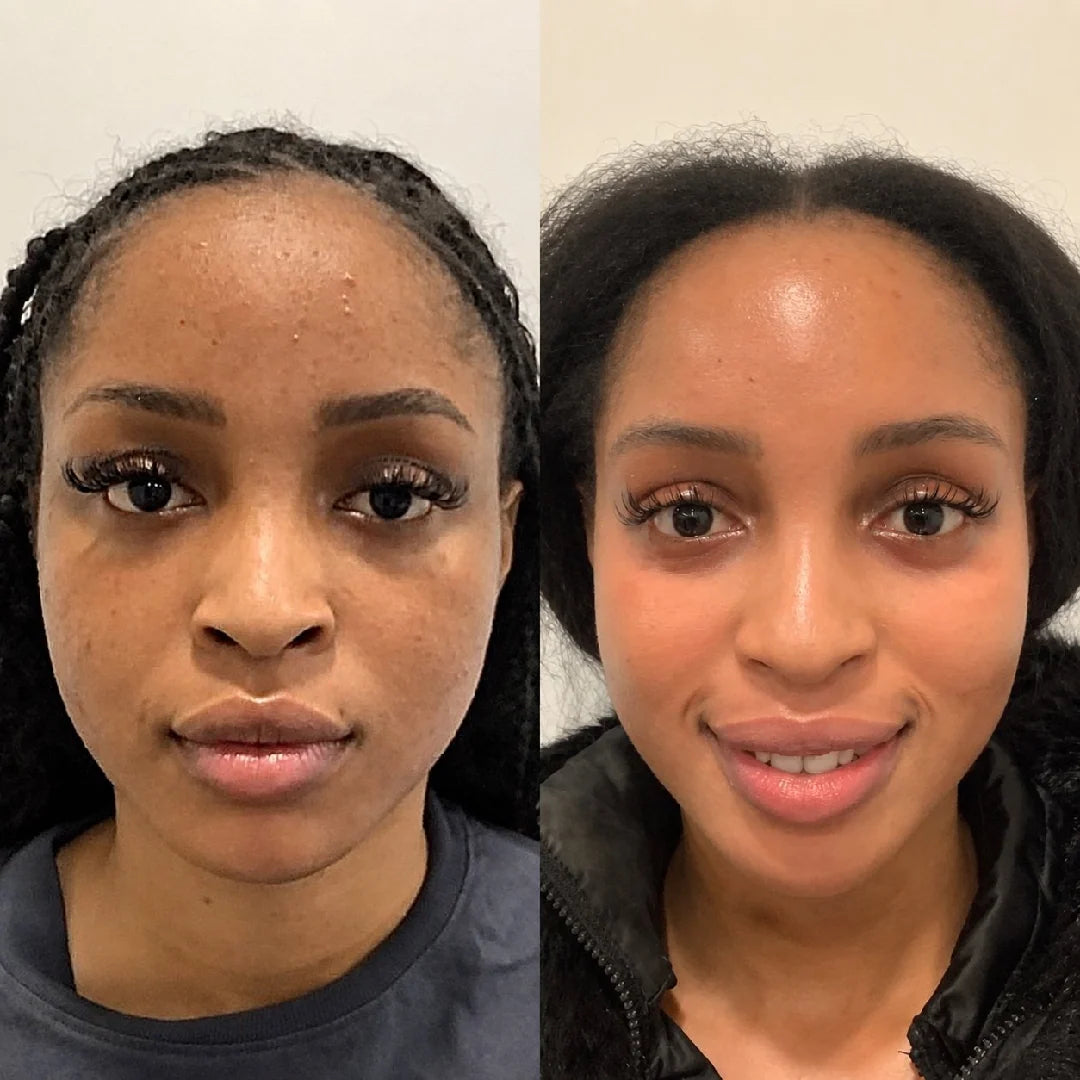 Fade the look of dark spots with consistent use
