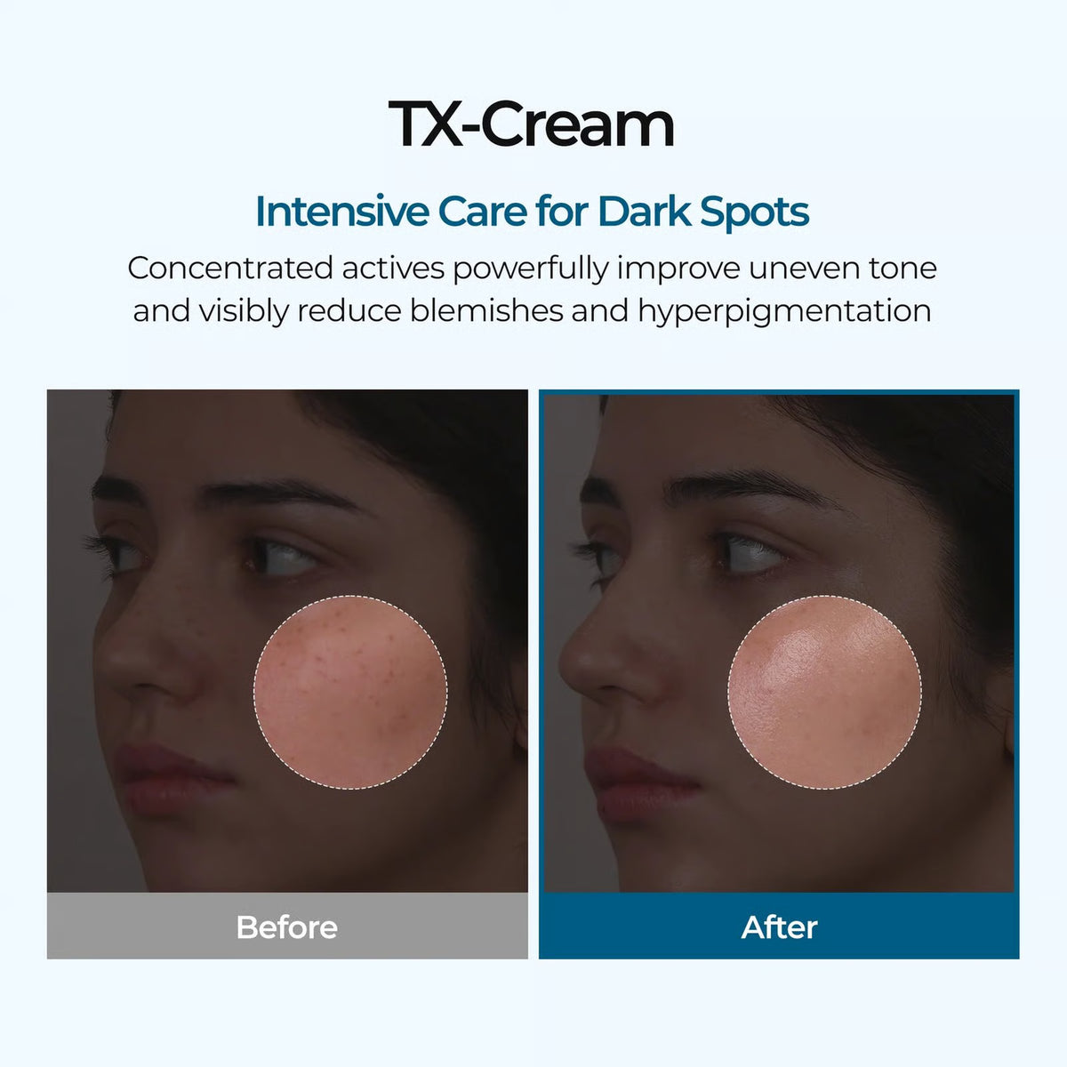 TX DARK SPOT CREAM