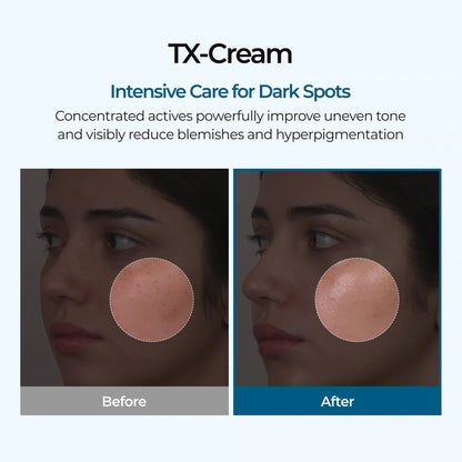 TX DARK SPOT CREAM